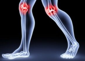 Reasons for developing the arthrosis of the knee